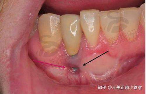 徐州美奥口腔医院收费特色