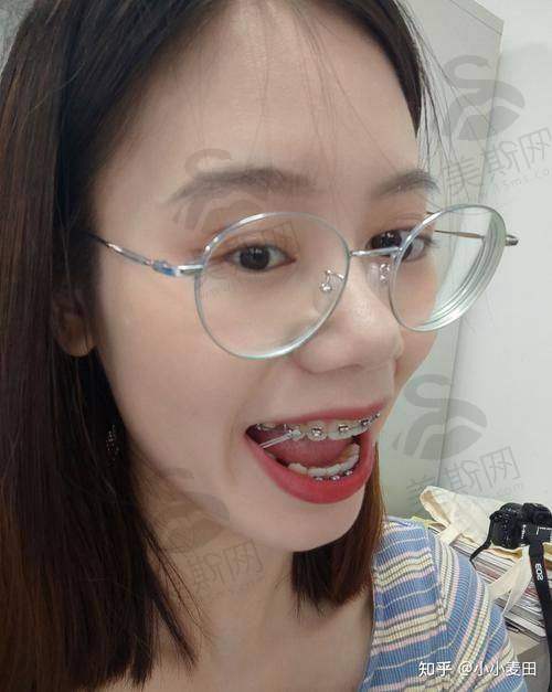 徐州正博口腔医院收费情况