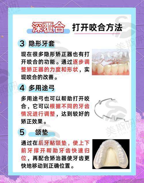 成都地区的骨性地包天矫正医生