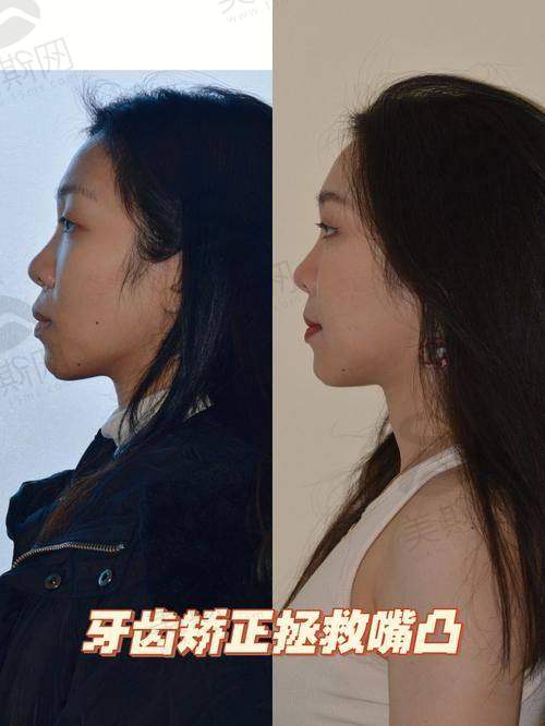 总结