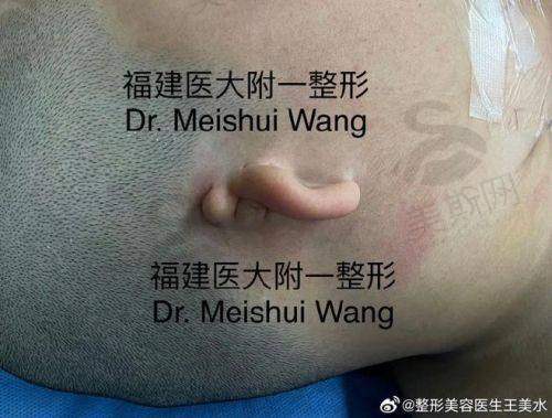 各医院优势项目价格对比