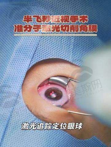 2025深圳眼科医院近视手术价格+检查费多少钱医生