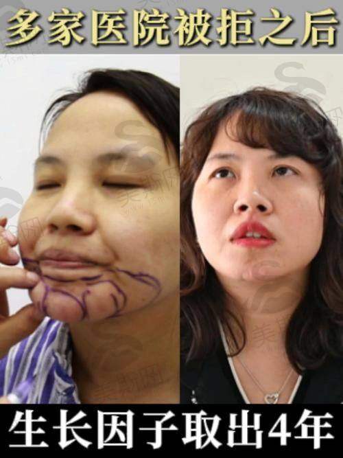 广州荔湾医院齐云香医生