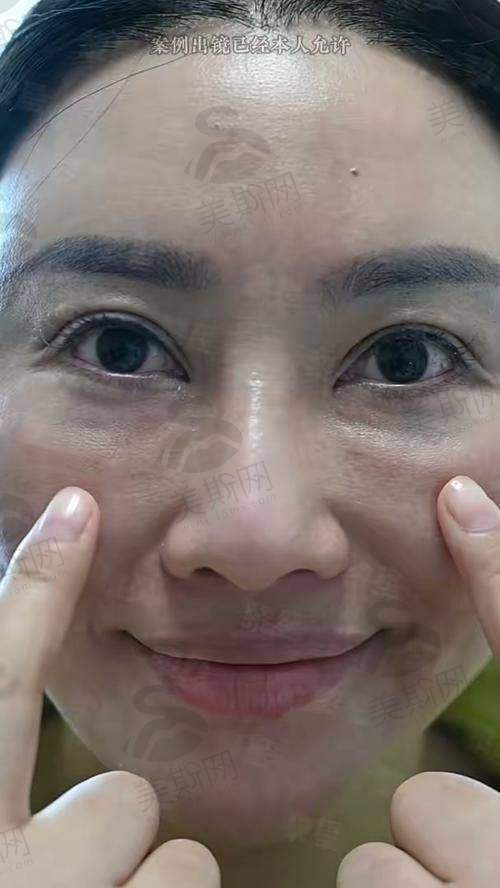 广州海峡谭新东医生