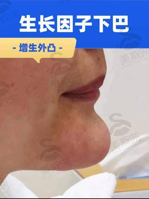 广州曙光整形医院蒋思军 医生