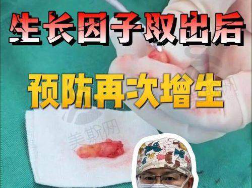 上海沪中医疗美容王洪的手术价格