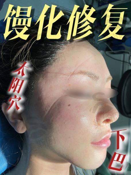 广州中家医家庭医生黄广香医生