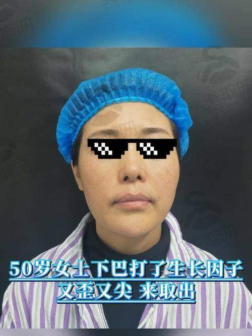 上海沪中王洪医生好吗
