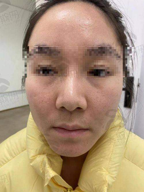 术前术后避坑指南