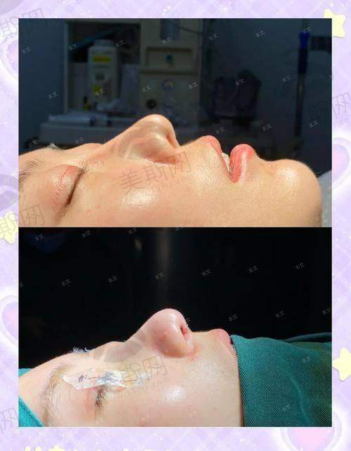 广州正规美容医院排行榜前十名都有谁？美莱、曙光、华美等榜上有名！ 