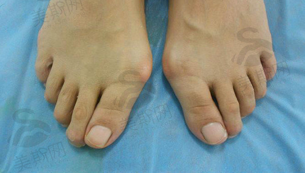 北京圣嘉新苏敬达失败修复案例怎么样？地址、价格、医生信息全揭秘，实力有保障！ 