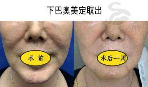 总结