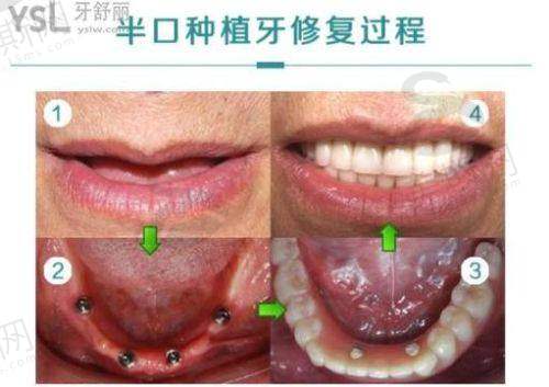 合肥中诺口腔