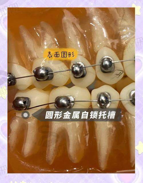 与其他深圳口腔医院的对比