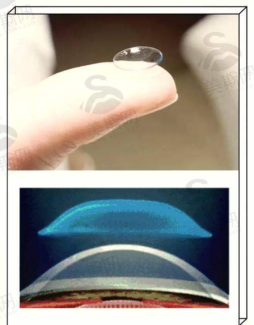 首都医 科 大学附属北京朝阳医院眼科正规靠谱吗?