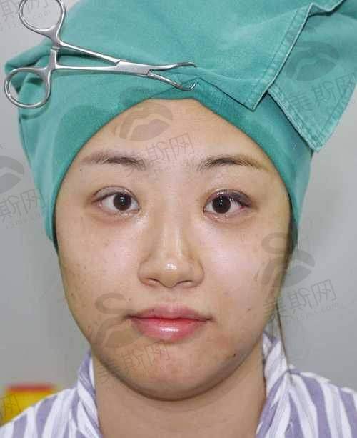 术前术后避坑指南