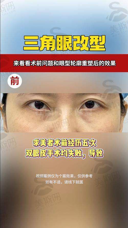 广州华美医院医生口碑实例