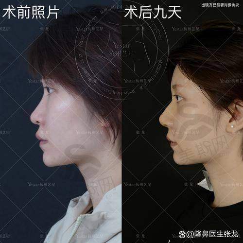 总结