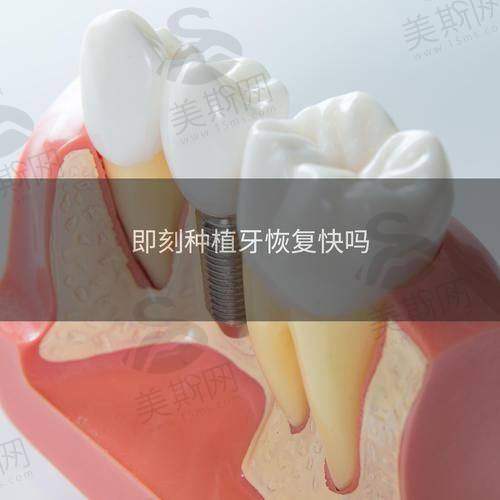 上海做活动假牙好的医院排名大揭秘！上海九院、上海同济医院等榜上有名！ 