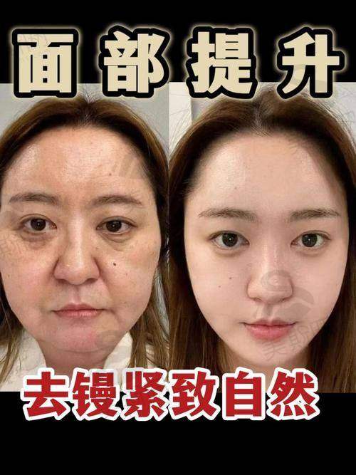 北京穆宝安医生的技术优势