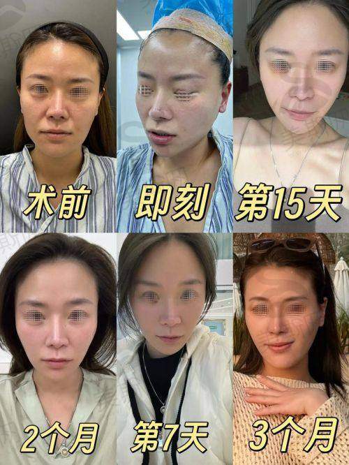 总结