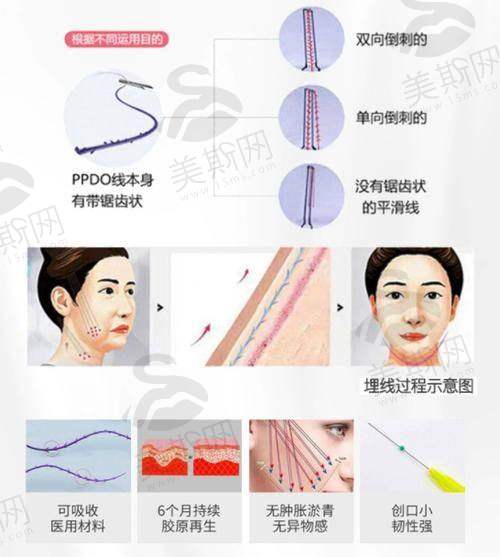术前术后避坑指南