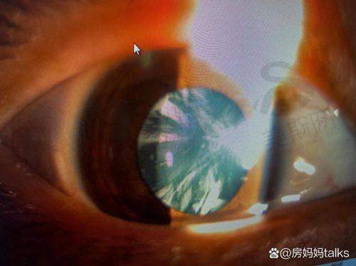 武汉十大眼科医院的口碑与评价