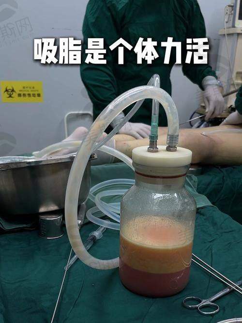 大同第三人民医院整形科口碑实例