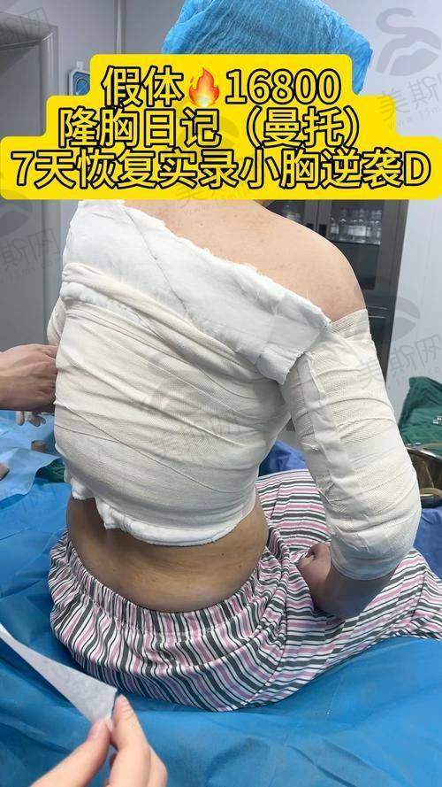 刘跃飞医生隆胸技术优势在哪