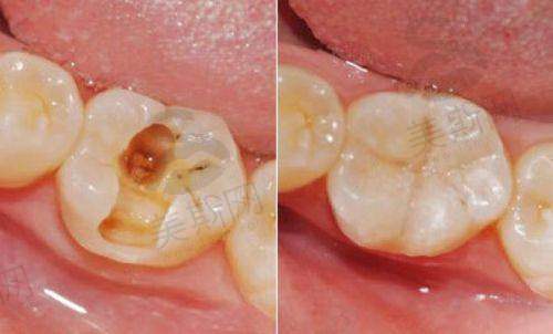 泸县种牙哪个医院比较好