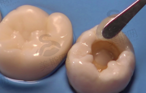 泸县看牙的地方在哪里