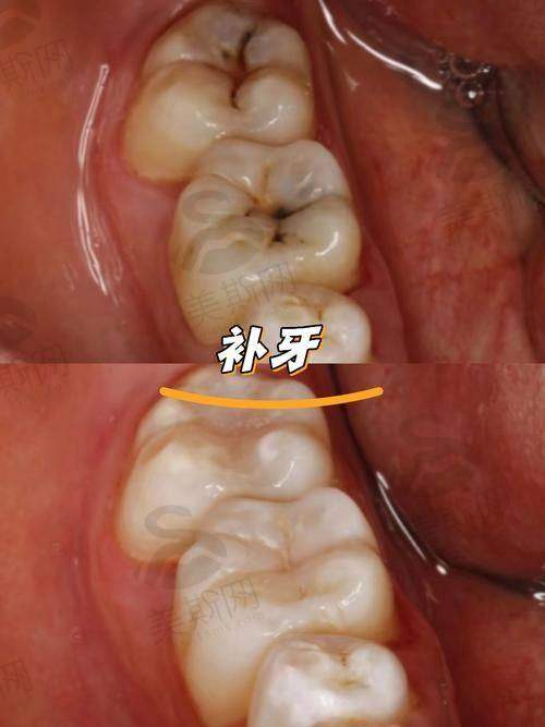 泸县看牙的地方叫什么