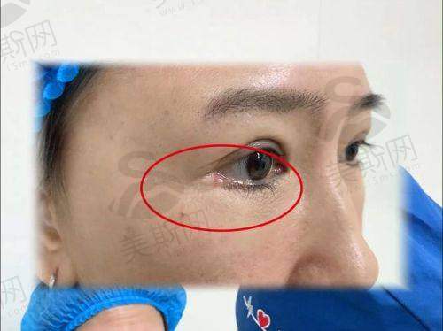吉林排名前6名整形医院的口碑实例