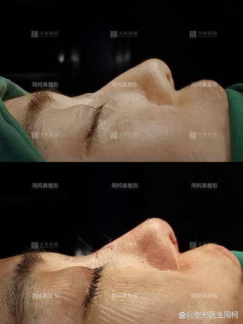三位医生的口碑实例分享