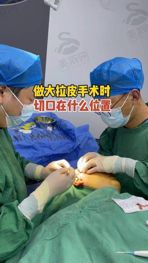 李建钢医生的无痕筋膜提升技术