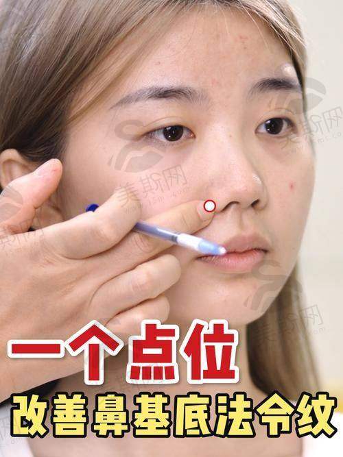 选择李建钢医生的关键要点