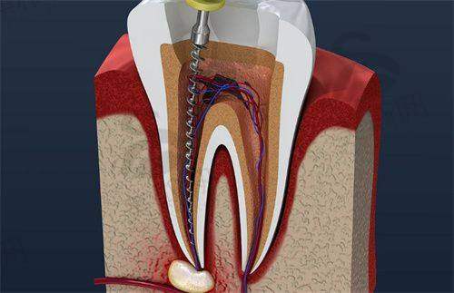 西藏昌都摩尔口腔医院特色技术