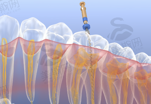 西藏昌都摩尔口腔医院是正规医院吗？