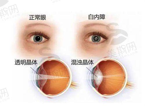 一、大连普兰店爱尔眼科医院怎么样?