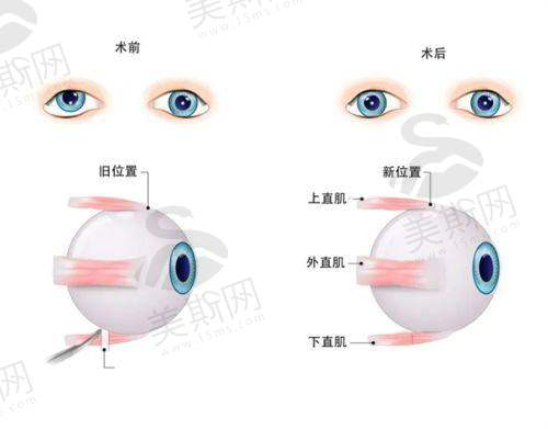 五、东莞友华普惠眼科医院诊疗项目