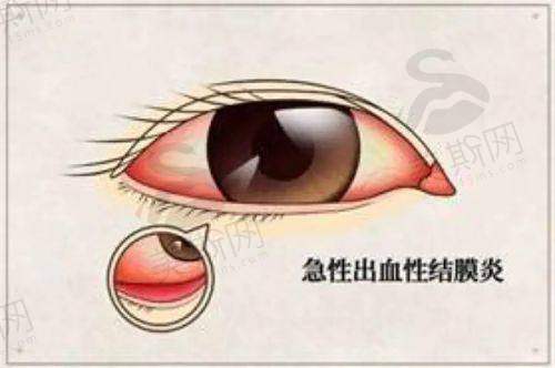 十一、宾阳爱尔眼科医院预约挂号
