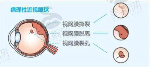 十、德州爱尔眼科医院地址电话