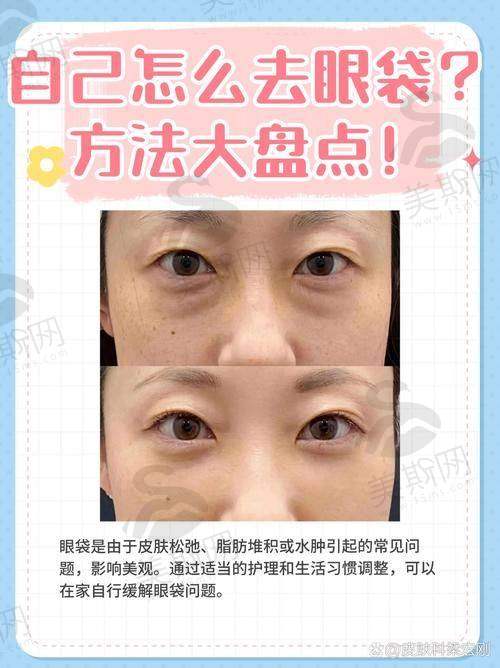术前术后避坑指南