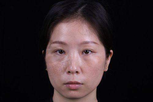 佛山曙光金子医学美容整形医院技术优势