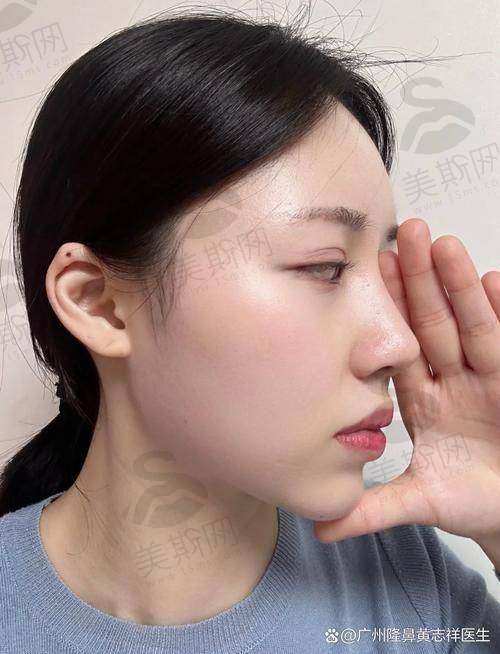 总结