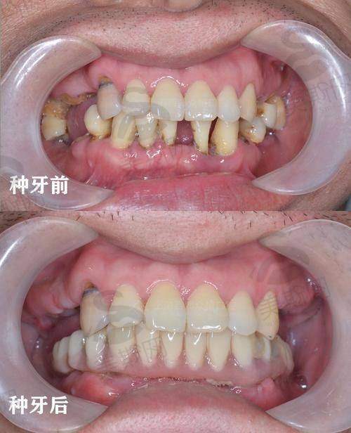 杭州牙科集团临平口腔院区特色技术