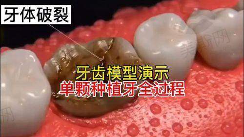 秦皇岛蓝天口腔医院是正规医院吗?