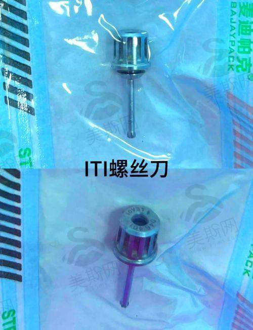 9、天津诺尔口腔门诊部真人口碑实例反馈