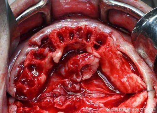 承德玥莱美医疗整形口腔医院地址电话及来院路线