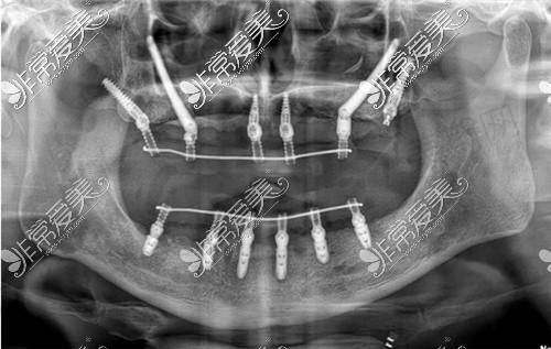 湖州金铂利口腔门诊部是国有的吗属于几级?